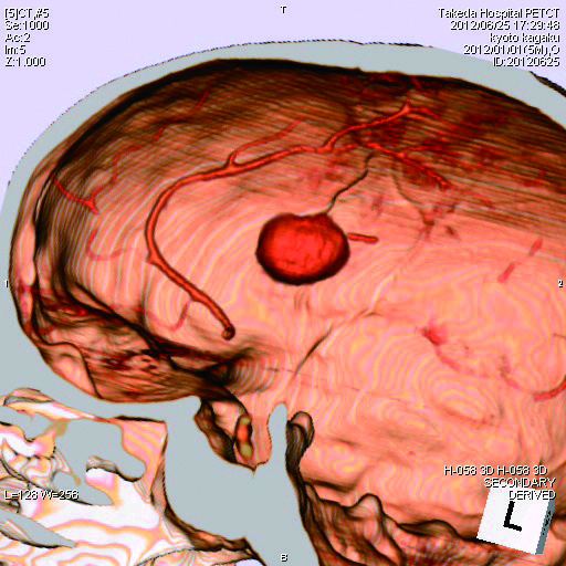 PH-2E CT Whole Body Phantom with Pathologies — fantoma Kyoto Kagaku distribuido en México por Radical One